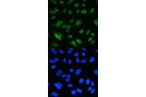 IF analysis of MSH2 using anti-MSH2 antibody (ABIN3043885). (MSH2 anticorps  (AA 337-583))