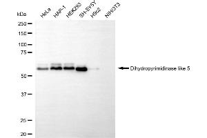 Western blotting analysis using dihydropyrimidinase like 5 antibody (ABIN7798340).