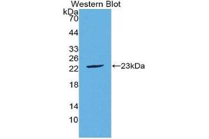Western Blotting (WB) image for anti-Fibroblast Growth Factor 21 (FGF21) (AA 29-209) antibody (ABIN1867952) (FGF21 anticorps  (AA 29-209))