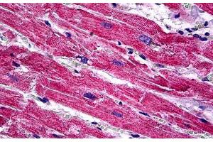 Human Heart: Formalin-Fixed, Paraffin-Embedded (FFPE)