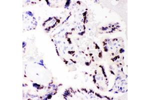 Anti- CEBP Beta Picoband antibody, IHC(P) IHC(P): Human Placenta Tissue