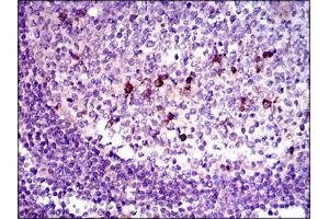 Image no. 1 for anti-Transforming Growth Factor, beta 1 (TGFB1) antibody (ABIN1491617) (TGFB1 anticorps)