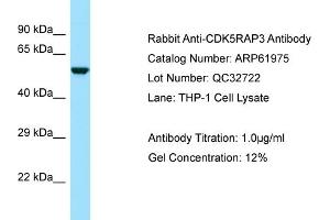 Western Blotting (WB) image for anti-CDK5 Regulatory Subunit Associated Protein 3 (CDK5RAP3) (N-Term) antibody (ABIN2788970) (CDK5RAP3 anticorps  (N-Term))
