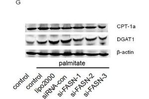 Down-regulation of FASN by siRNA attenuated triglyceride accumulation(A and B) Protein level of FASN in HepG2 cells.