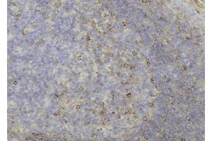 ABIN6273689 at 1/100 staining Human lymph node tissue by IHC-P. (KRT81 anticorps  (C-Term))