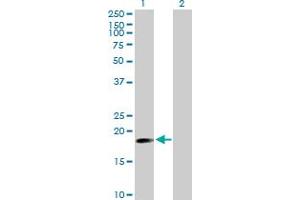 Western Blot analysis of TNFAIP8 expression in transfected 293T cell line by TNFAIP8 MaxPab polyclonal antibody. (TNFAIP8 anticorps  (AA 1-190))