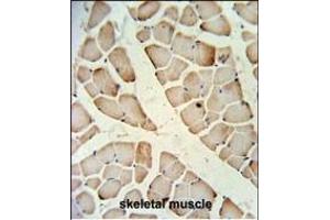 HFE2 Antibody (Center) (ABIN653653 and ABIN2842994) IHC analysis in formalin fixed and paraffin embedded skeletal muscle followed by peroxidase conjugation of the secondary antibody and DAB staining.