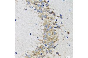 Immunohistochemistry of paraffin-embedded rat brain using CDK1 antibody.