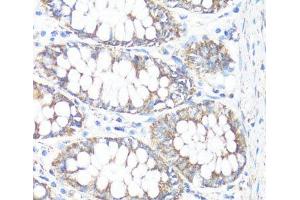 Immunohistochemistry of paraffin-embedded Human colon using HSD17B10 Polyclonal Antibody at dilution of 1:100 (40x lens).