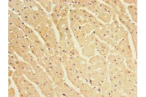 Immunohistochemistry of paraffin-embedded human heart tissue using ABIN7145462 at dilution of 1:100 (CRYBA1 anticorps  (AA 1-215))