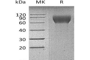 Western Blotting (WB) image for CD6 (CD6) protein (His tag) (ABIN7320847) (CD6 Protein (CD6) (His tag))