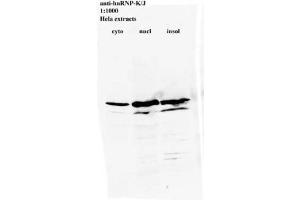 Image no. 2 for anti-Heterogeneous Nuclear Ribonucleoprotein K (HNRNPK) antibody (ABIN108575) (HNRNPK anticorps)