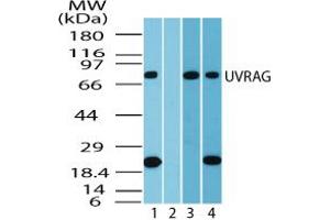 Image no. 1 for anti-UV Radiation Resistance Associated Gene (UVRAG) (AA 375-425) antibody (ABIN960401) (UVRAG anticorps  (AA 375-425))