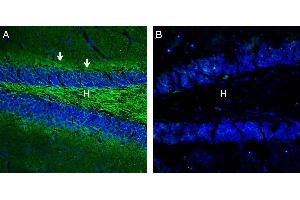 Expression of Neurofascin in mouse hippocampus. (NFASC anticorps  (C-Term, Intracellular))