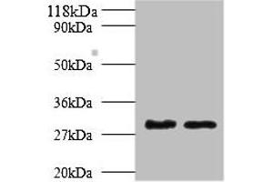Western blot All lanes: Tpsb2 antibody at 2 μg/mL Lane 1: Mouse heart tissue Lane 2: Rat heart tissue Secondary Goat polyclonal to rabbit IgG at 1/10000 dilution Predicted band size: 31, 26 kDa Observed band size: 31 kDa (TPSB2 anticorps  (AA 32-276))