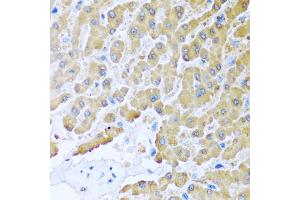 Immunohistochemistry of paraffin-embedded human liver using CCL8 antibody (ABIN5975074) at dilution of 1/100 (40x lens).