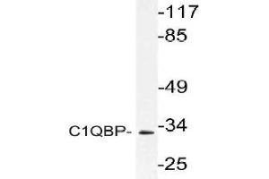 Western blot (WB) analysis of C1QBP antibody in extracts from Jurkat cells. (C1QBP anticorps)