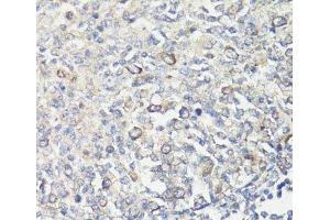 Immunohistochemistry of paraffin-embedded Human tonsil using MUL1 Polyclonal Antibody at dilution of 1:100 (40x lens). (MUL1 anticorps)