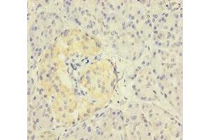 Immunohistochemistry of paraffin-embedded human pancreatic tissue using ABIN7176105 at dilution of 1:100 (ZNF114 anticorps  (AA 1-414))