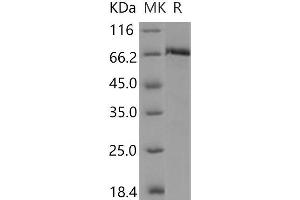 Western Blotting (WB) image for Met Proto-Oncogene (MET) (AA 956-1390) (Active) protein (GST tag,His tag) (ABIN7317093)