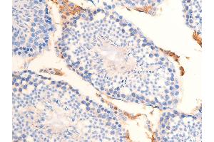 ABIN6267253 at 1/100 staining mouse testicular tissue sections by IHC-P. (CHEK2 anticorps  (pThr68))