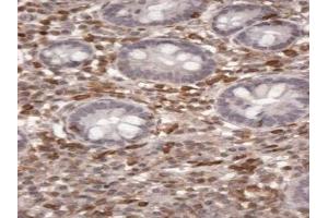 IHC staining of FFPE human small intestine lymphatic cells with S100A4 antibody at 2ug/ml. (s100a4 anticorps)