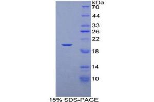 SDS-PAGE analysis of Rat Elongin A Protein.