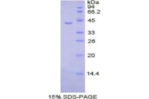 SDS-PAGE analysis of Human PDHa Protein. (PDHa Protéine)