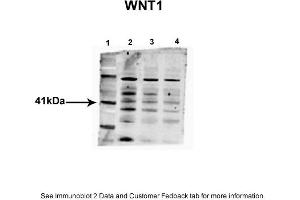 Sample Type: 1. (WNT1 anticorps  (Middle Region))