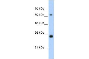 WB Suggested Anti-PCNA Antibody Titration:  1. (PCNA anticorps  (C-Term))