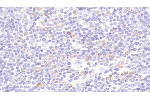 Detection of PRKAb1 in Human Colon Tissue using Polyclonal Antibody to Protein Kinase, AMP Activated Beta 1 (PRKAb1)