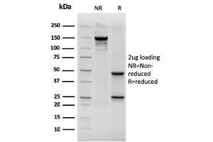 SDS-PAGE Analysis Purified CK19 Mouse Recombinant Monoclonal Antibody (rKRT19/800).