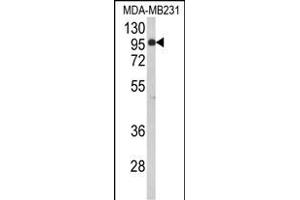 Western blot analysis of BAHD1 Antibody (C-term) (ABIN653104 and ABIN2842693) in MDA-M cell line lysates (35 μg/lane). (BAHD1 anticorps  (C-Term))