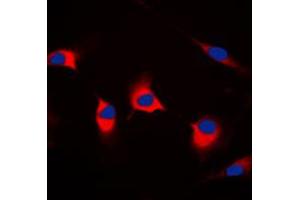 Immunofluorescent analysis of DFF45 staining in HeLa cells. (DFFA anticorps  (Center))
