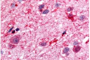 Human Brain (formalin-fixed, paraffin-embedded) stained with DRD1 antibody ABIN213460 at 1-5 ug/ml followed by biotinylated goat anti-rabbit IgG secondary antibody ABIN481713, alkaline phosphatase-streptavidin and chromogen.