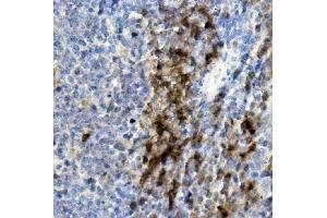 IHC analysis of CD8 alpha/Cd8a using anti-CD8 alpha/Cd8a antibody (ABIN7601570).