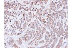IHC-P Image Immunohistochemical analysis of paraffin-embedded MDA-MB-468 xenograft, using Cyclophilin A, antibody at 1:500 dilution.