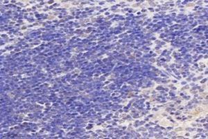 Immunohistochemistry analysis of paraffin-embedded mouse thymus using,PPIL2 (ABIN7075005) at dilution of 1: 3600