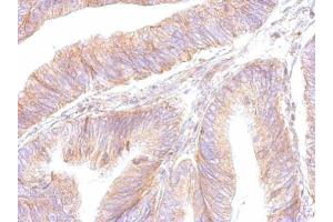 IHC-P Image ATP synthase B1 antibody detects ATP5F1 protein at cytosol on human colon by immunohistochemical analysis. (ATP Synthase B1 (Center) anticorps)