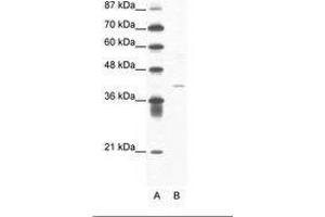 Image no. 1 for anti-Hypoxia Inducible Factor 1, alpha Subunit Inhibitor (HIF1AN) (N-Term) antibody (ABIN202309)