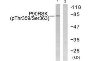 Western blot analysis of extracts from 293 cells treated with PMA 125ng/ml 30', using p90 RSK (Phospho-Thr359+Ser363) Antibody. (RPS6KA3 anticorps  (pThr359))