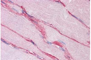 Human Skeletal Muscle: Formalin-Fixed, Paraffin-Embedded (FFPE) (SGCB anticorps  (AA 87-197))