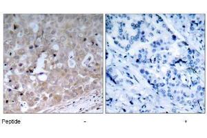 Image no. 1 for anti-VEGF Receptor 2 (VEGFR2) (Tyr1175) antibody (ABIN197237) (VEGFR2/CD309 anticorps  (Tyr1175))