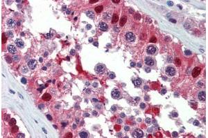 Human Testis (formalin-fixed, paraffin-embedded) stained with Ubiquitin antibody ABIN462018 at 10 ug/ml followed by biotinylated anti-mouse IgG secondary antibody ABIN481714, alkaline phosphatase-streptavidin and chromogen.