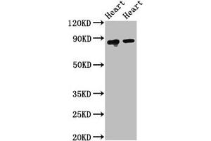 Western Blot Positive WB detected in: Rat heart tissue, Mouse heart tissue All lanes: ACO2 antibody at 2. (ACO2 anticorps  (AA 452-676))