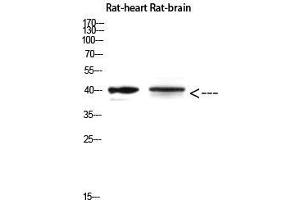 Western Blot (WB) analysis of Rat Heart and Rat Brain using Cerberus Polyclonal Antibody diluted at 1:500. (CER1 anticorps  (Internal Region))