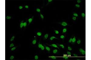 Immunofluorescence of monoclonal antibody to HEYL on HeLa cell. (HEYL anticorps  (AA 221-327))