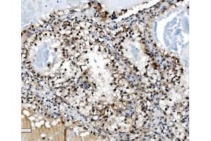 IHC analysis of PRDM14 using anti-PRDM14 antibody (ABIN7603152).