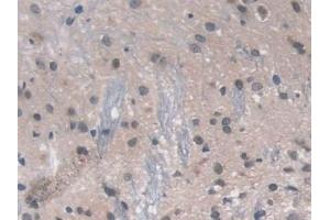 Detection of RAGE in Rat Spinal cord Tissue using Polyclonal Antibody to Renal Tumor Antigen (RAGE)