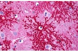 Anti-SLC1A2 / EAAT2 antibody IHC staining of human brain, astrocytes. (SLC1A2 anticorps  (C-Term))